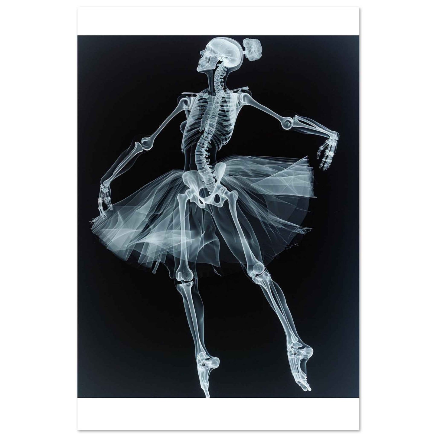 "Skeleton Ballerina" Poster – Ethereal X-Ray Dance Art (Multiple Sizes Available)