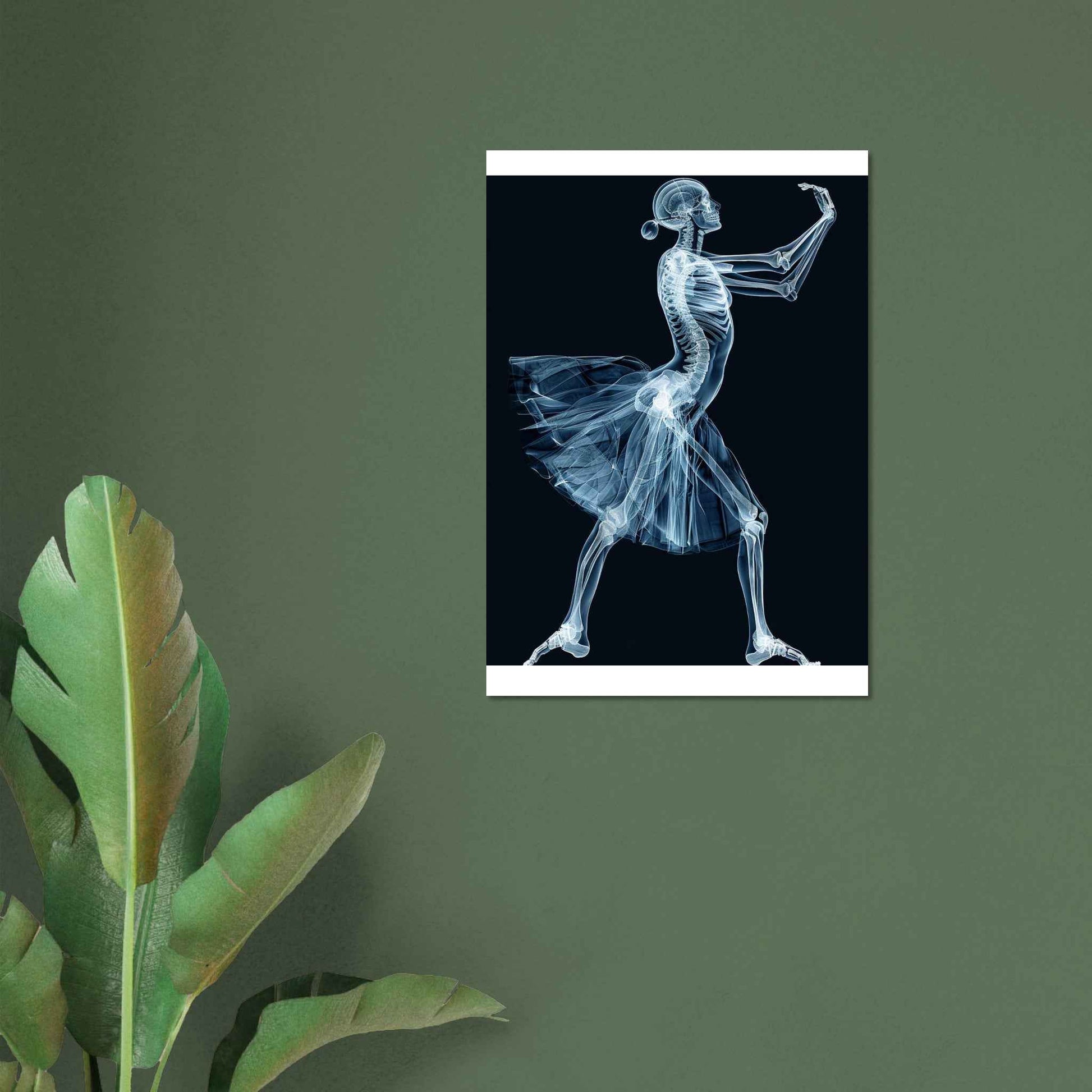 “X-Ray Ballerina” Poster – Ethereal Anatomical Dance Wall Art (Multiple Sizes Available)