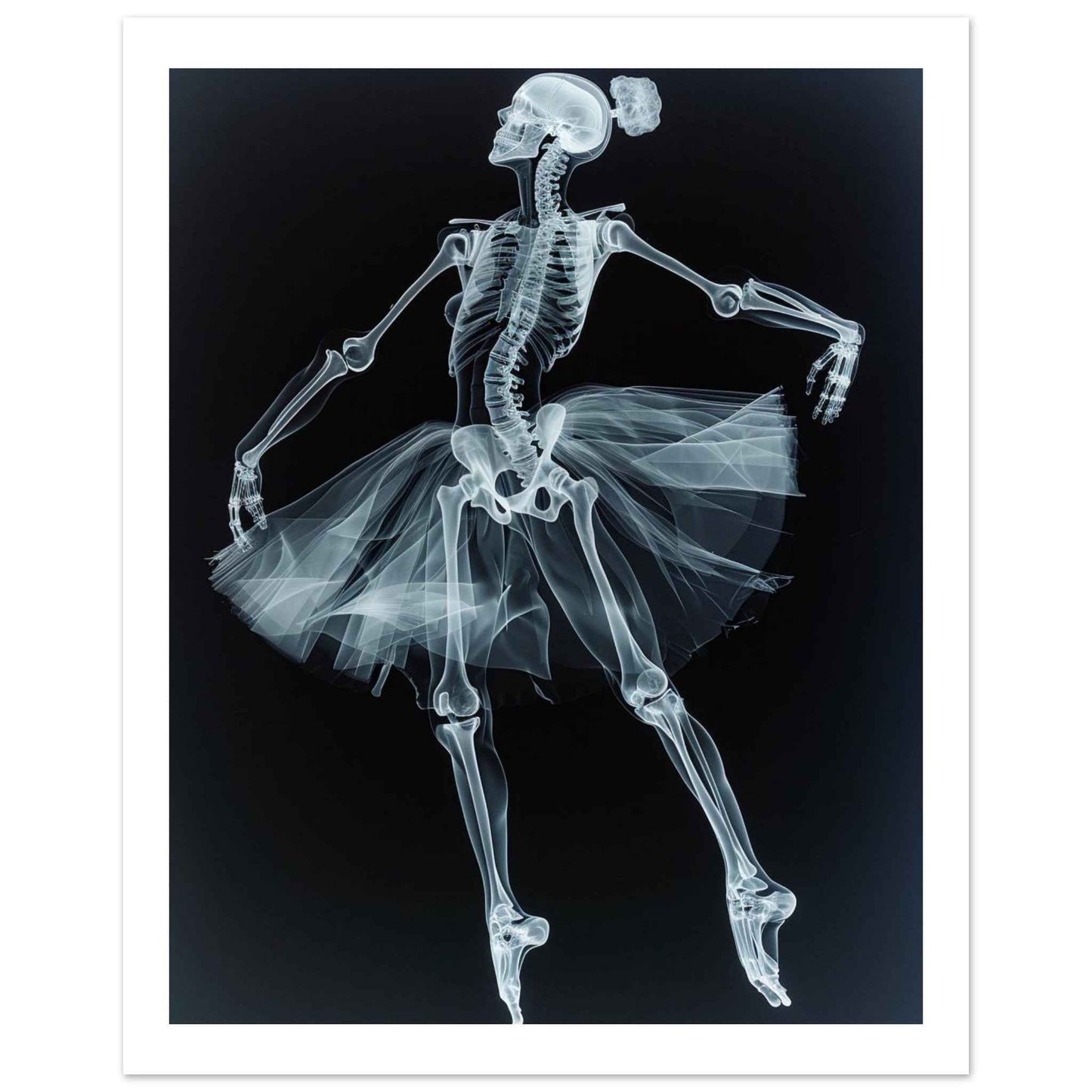 "Skeleton Ballerina" Poster – Ethereal X-Ray Dance Art (Multiple Sizes Available)