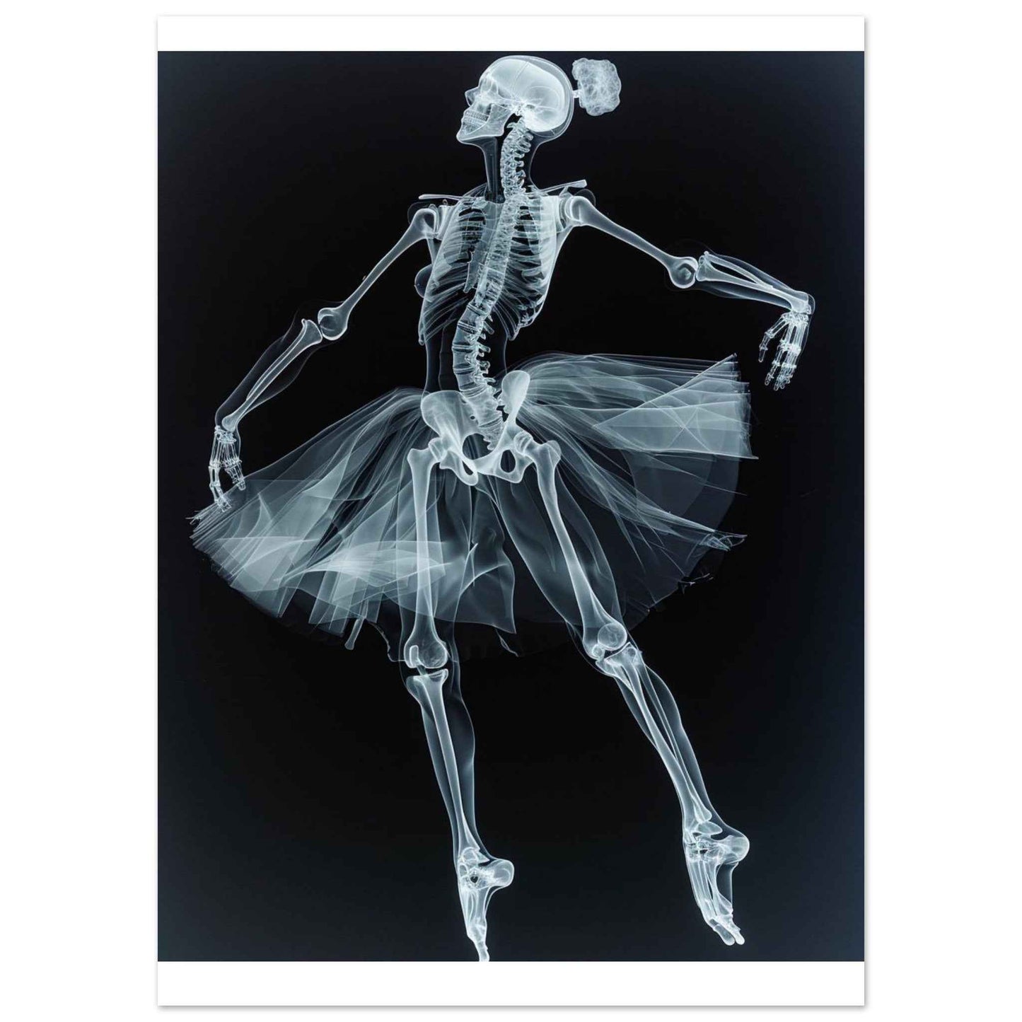 "Skeleton Ballerina" Poster – Ethereal X-Ray Dance Art (Multiple Sizes Available)