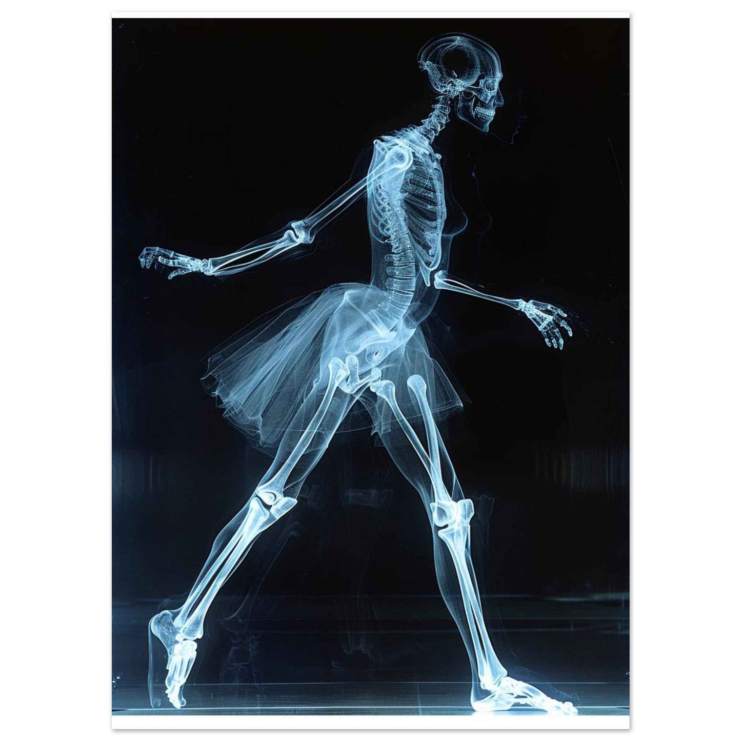 "Skeleton Ballerina" Poster – Ethereal X-ray Dance Wall Art (Multiple Sizes Available)
