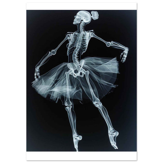"Skeleton Ballerina" Poster – Ethereal X-Ray Dance Art (Multiple Sizes Available)