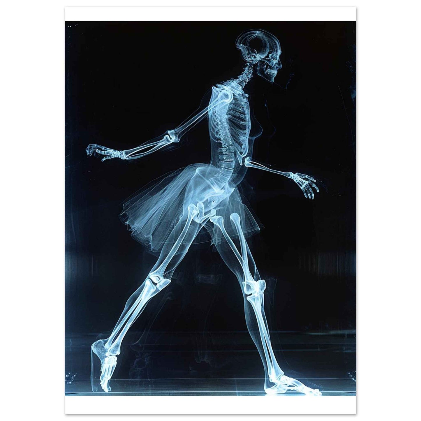 "Skeleton Ballerina" Poster – Ethereal X-ray Dance Wall Art (Multiple Sizes Available)