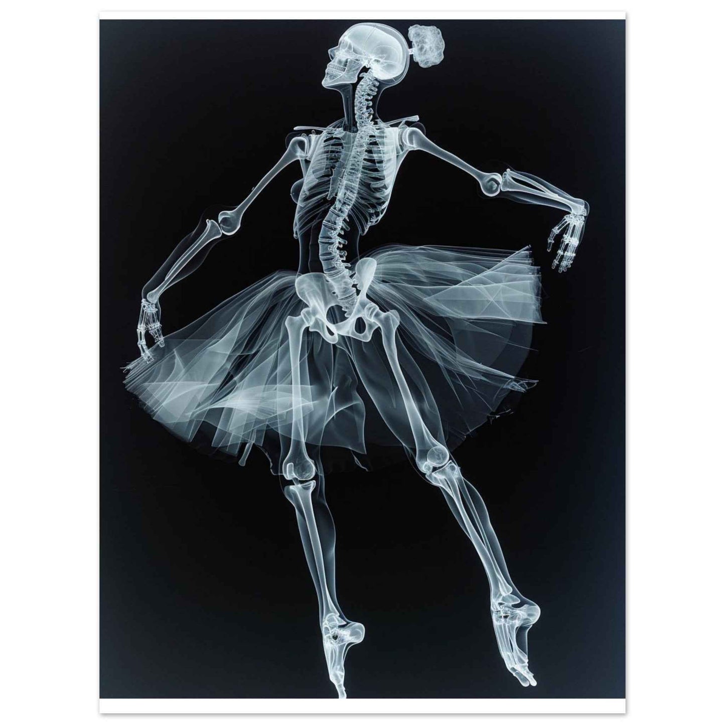 "Skeleton Ballerina" Poster – Ethereal X-Ray Dance Art (Multiple Sizes Available)