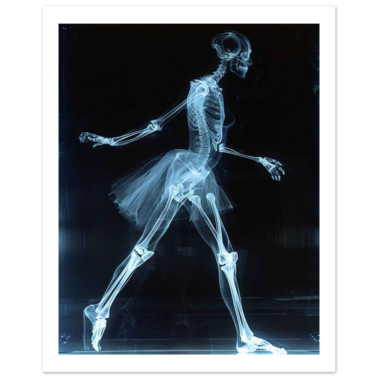 "Skeleton Ballerina" Poster – Ethereal X-ray Dance Wall Art (Multiple Sizes Available)
