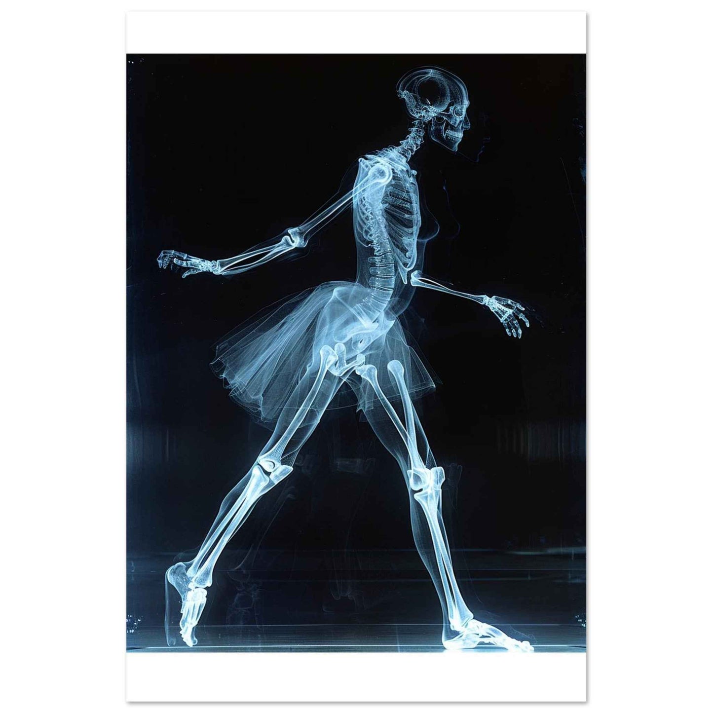 "Skeleton Ballerina" Poster – Ethereal X-ray Dance Wall Art (Multiple Sizes Available)