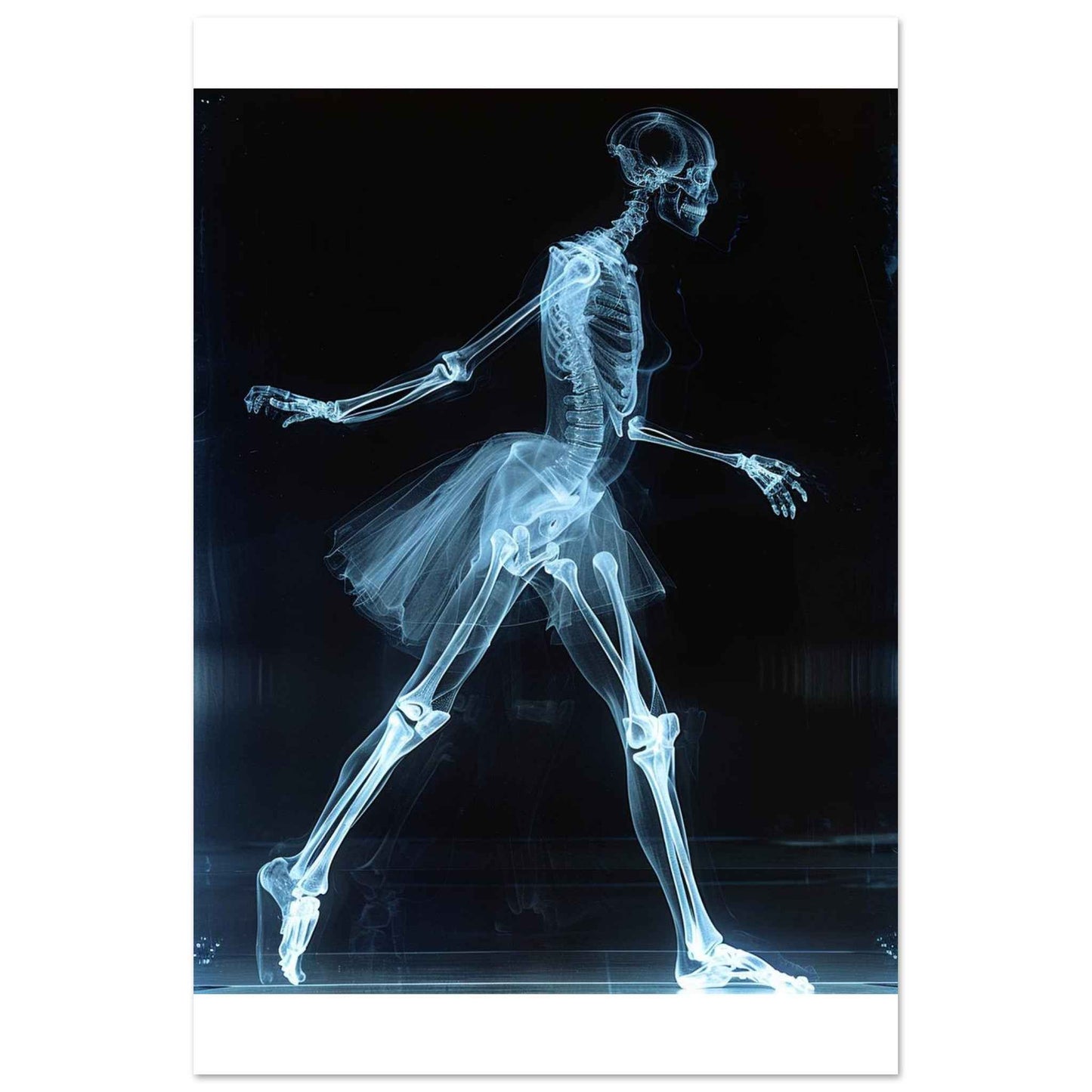 "Skeleton Ballerina" Poster – Ethereal X-ray Dance Wall Art (Multiple Sizes Available)