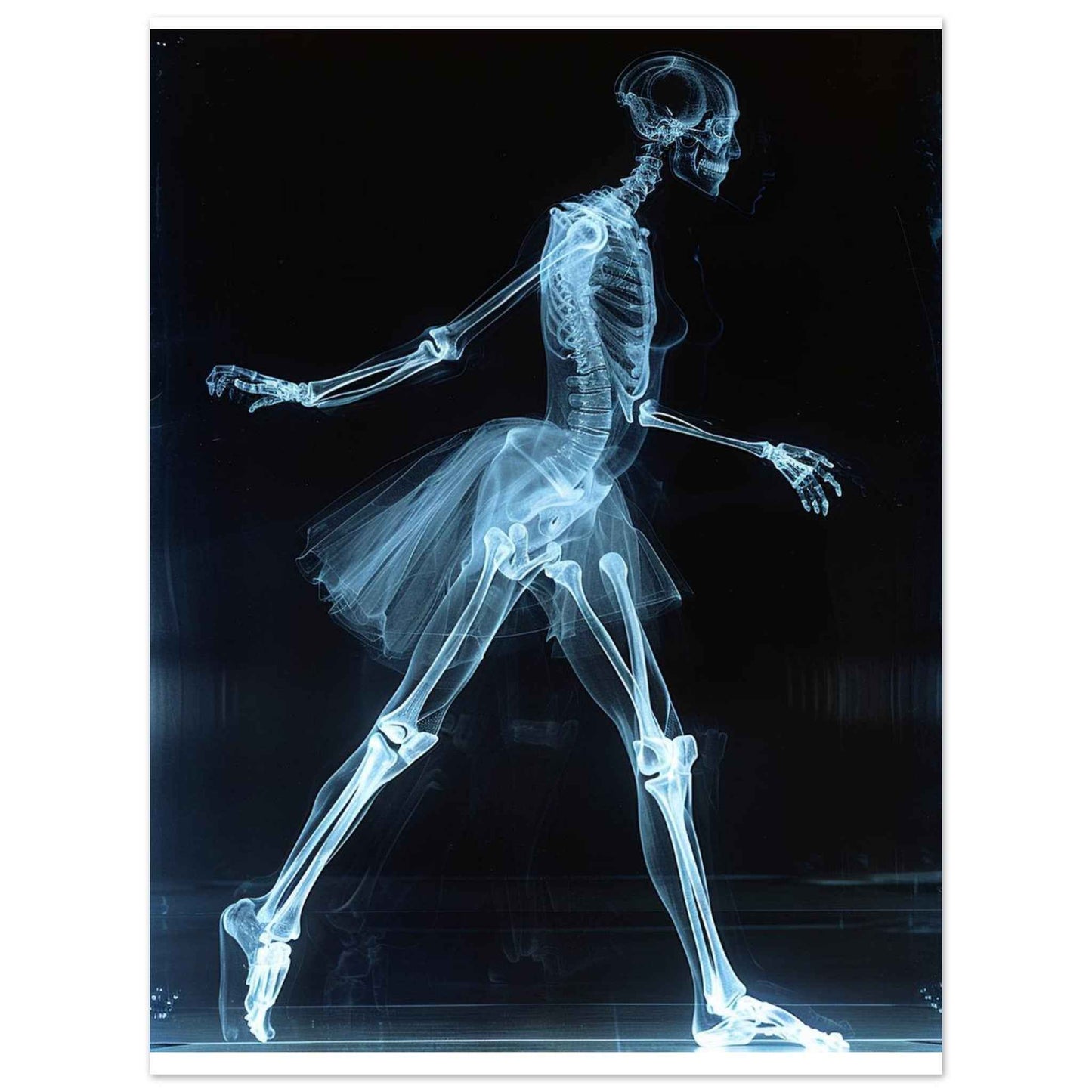 "Skeleton Ballerina" Poster – Ethereal X-ray Dance Wall Art (Multiple Sizes Available)